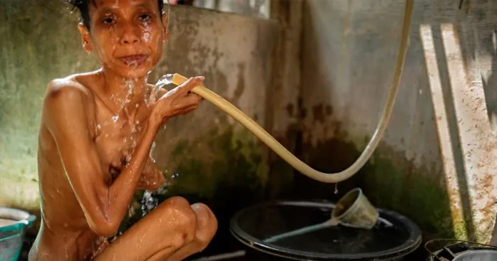 Shocking Photos Of Indonesia’s Mentally Ill Patients Show Their Disturbing Living Conditions