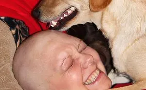 Cancer- Do Your Friends & Family A Favor...