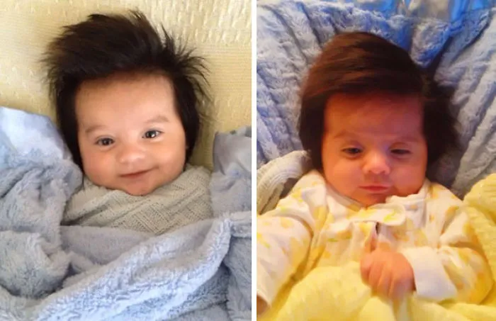 2months Old, Not A Wig