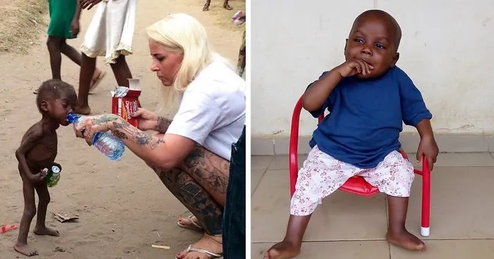 2-Year-Old 'Witch Child' Who Was Left To Die Makes Stunning Recovery