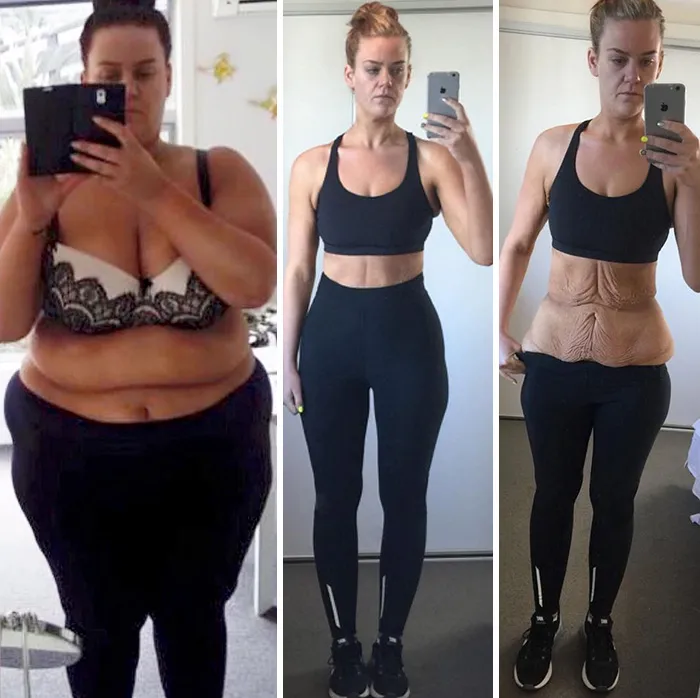 I Am Officially Half The Person I Was 11 Months Ago! From 169 Kg (372 Lbs) To 83.85 Kg (184.86 Lbs)