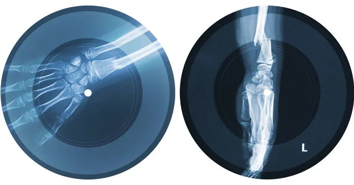 The Sound Of Violence: Victim X-Ray Records Depict 2 Out Of 3 Women Suffering In Turkey