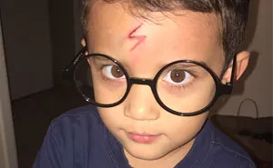 Mom Turns Crying Kid's Cut Into Harry Potter Lighting Bolt, Makes Him Happy Again