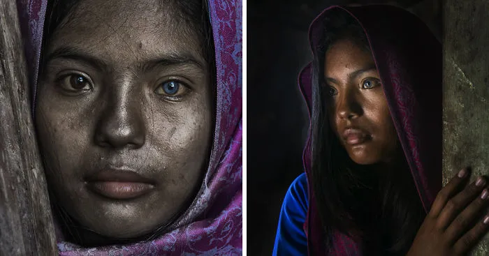 Sapa Is A 'Cham' Girl In Ninh Thuan Who Has Two Different Colored Eyes