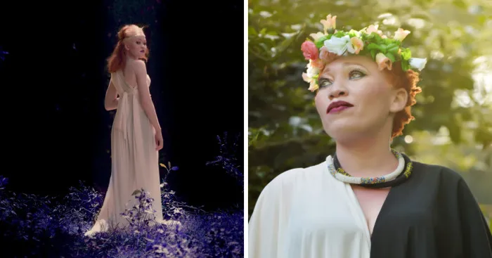 I Photographed Women Living With Albinism To Make The World See Beyond Their Skin Condition