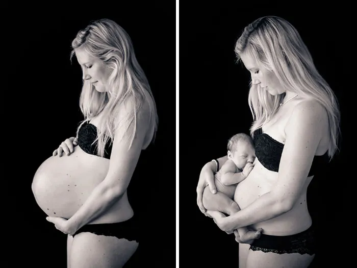 90 Before & After Pics Of Mothers Going Through The Most Beautiful Transformation