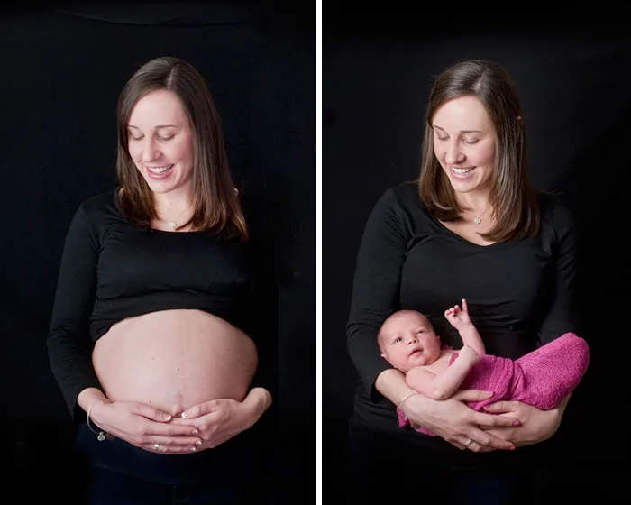 90 Before & After Pics Of Mothers Going Through The Most Beautiful Transformation