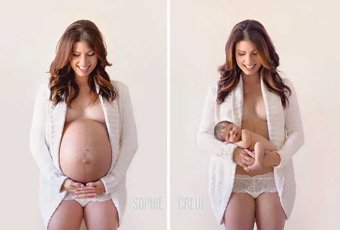 90 Before & After Pics Of Mothers Going Through The Most Beautiful Transformation