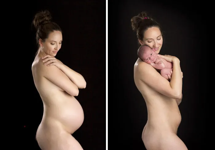 90 Before & After Pics Of Mothers Going Through The Most Beautiful Transformation
