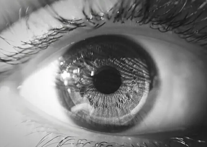 Eye