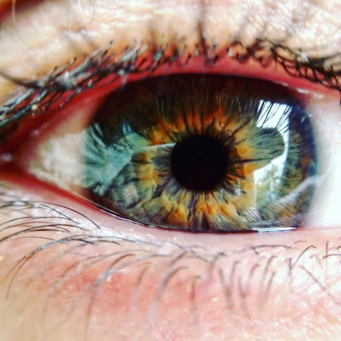 Eyes