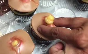 Pimple Cupcakes With Squeezable Heads Are A Thing Now (Unfortunately)