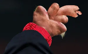 I Lost Sleep Thanks To Mutant Donald Trump