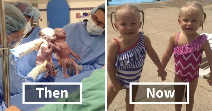 Twins Born Holding Hands 2 Years Ago Are Now Closer Than Ever