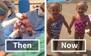 Twins Born Holding Hands 2 Years Ago Are Now Closer Than Ever