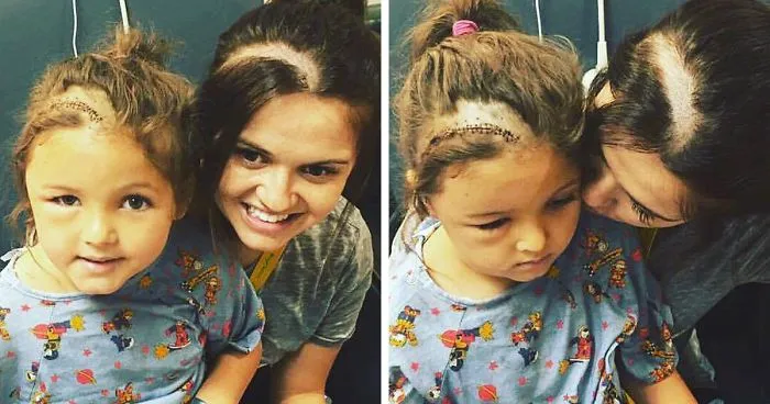 Mom Shaves Her Head So Her Daughter Wouldn't Feel Different After Brain Surgery