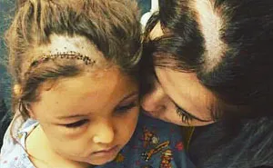 Mom Shaves Her Head So Her Daughter Wouldn't Feel Different After Brain Surgery