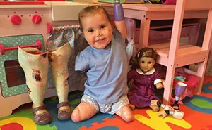 2-Year-Old Girl Gets Quadruple Amputee Doll That Looks Just Like Her