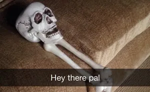Guy Snapchats Sad Story About His Skull And It Becomes Viral Sensation