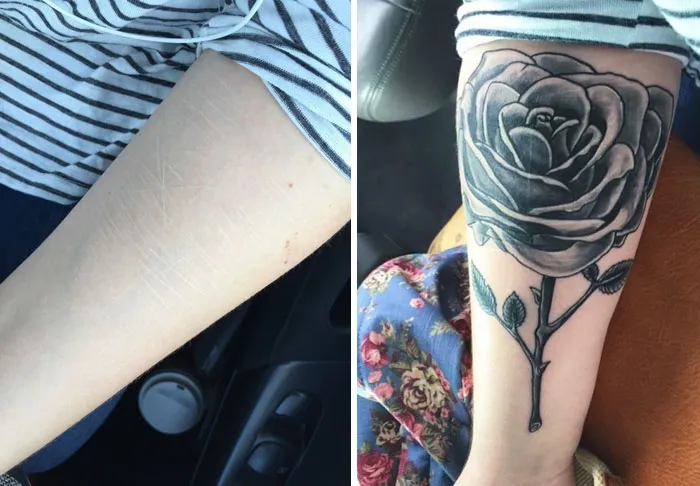 Arm scar covered by a rose tattoo transformation.