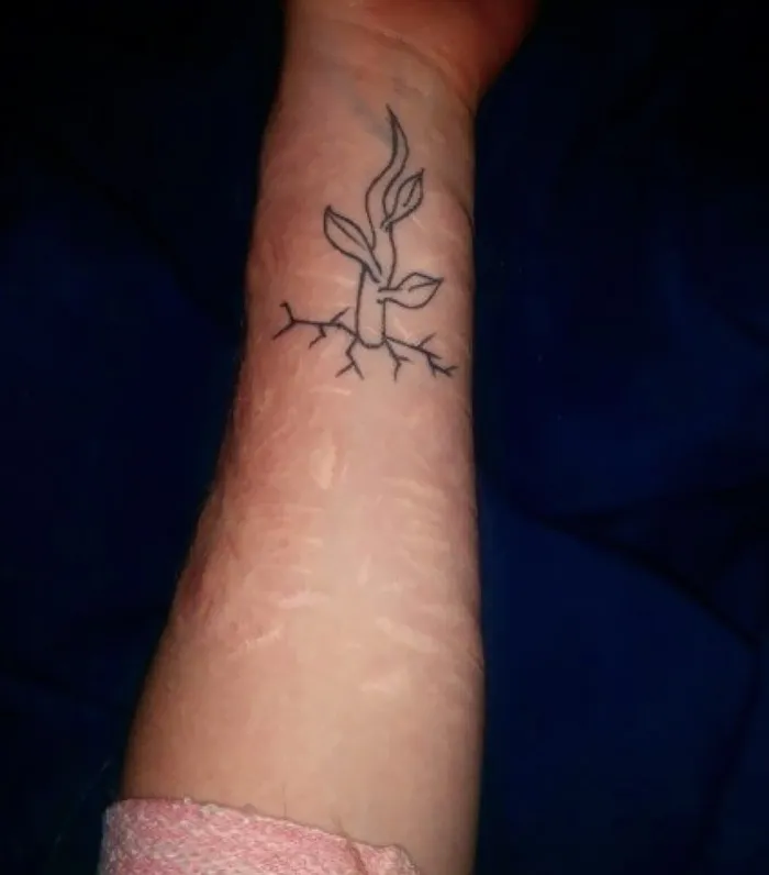 Tattoo of a plant with roots on a forearm, covering a scar.