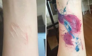 34 Scar-Covering Tattoos With Amazing Stories Behind Them