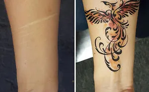 34 Scar-Covering Tattoos With Amazing Stories Behind Them