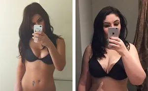This Mom's Powerful Before-And-After Photos Will Change The Way You Look At Your Body