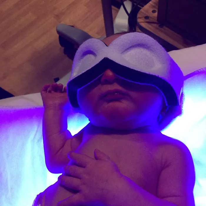 Making Sure Baby Has That Nice Tan Before Leaving Hospital.