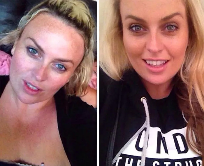 Before and after photos showing the impact of quitting drinking, highlighting positive changes in appearance.