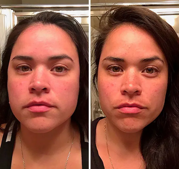 Before and after comparison showing effects of stopping drinking.