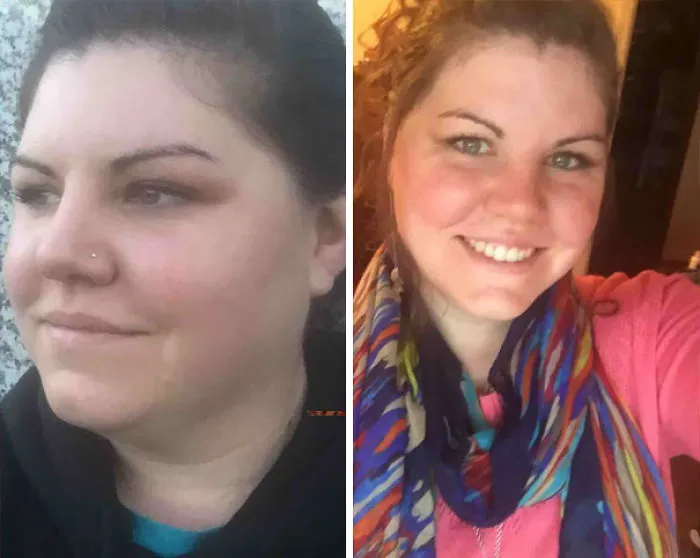 Before-and-after photos showing the positive effects of quitting drinking.