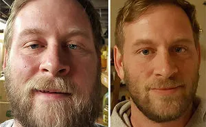 127 Before-And-After Pics Show What Happens When You Stop Drinking