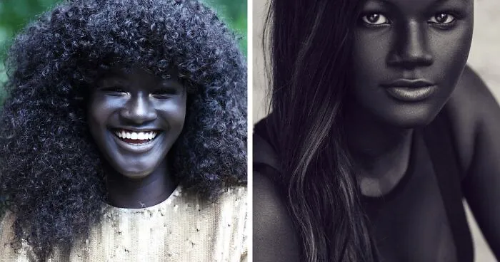 Teen Bullied For Her Incredibly Dark Skin Color Becomes A Model, Takes The Internet By Storm