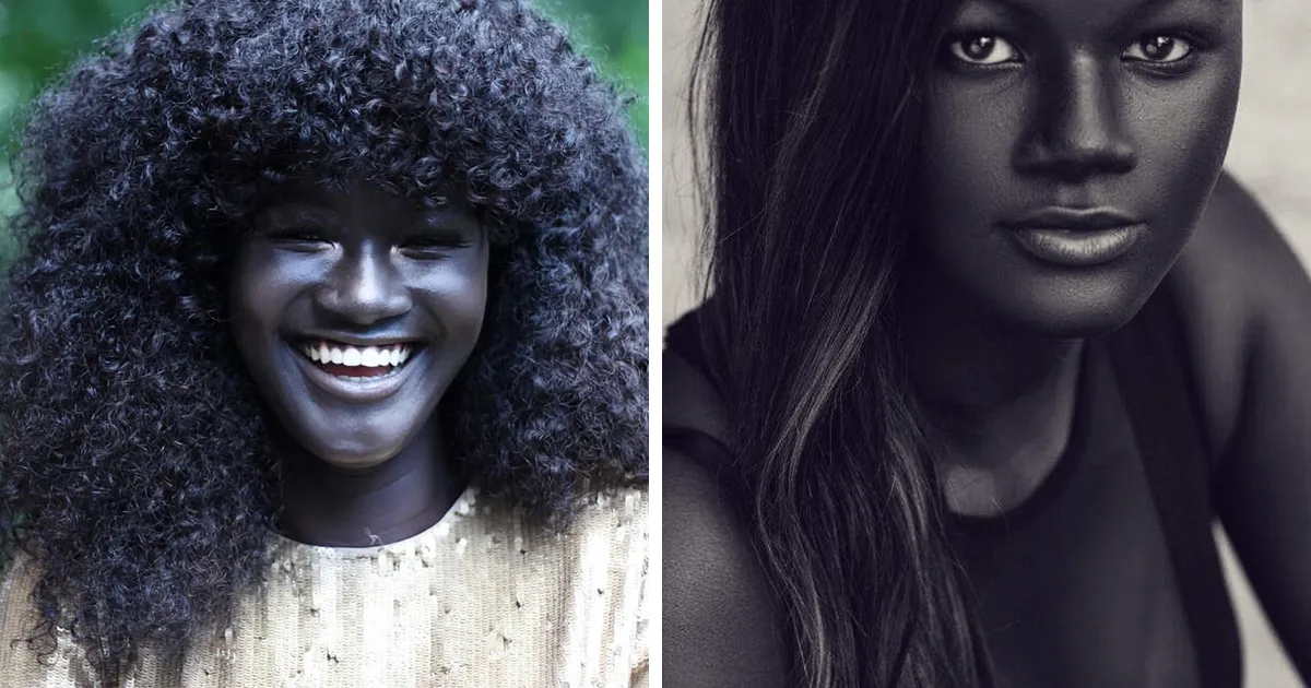 Esta adolescente acosada por su color de piel increíblemente oscuro se convierte en modelo y conquista internet