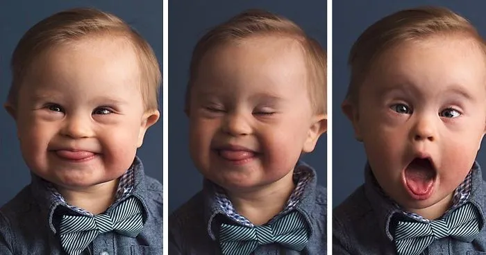 Kid Gets Rejected From Ad Campaign "Because He Has Down's Syndrome", Mom Fights Back