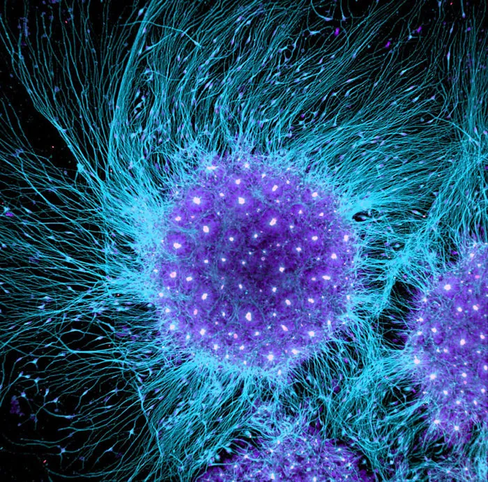 Nineteenth Place. Human Neural Rosette Primordial Brain Cells