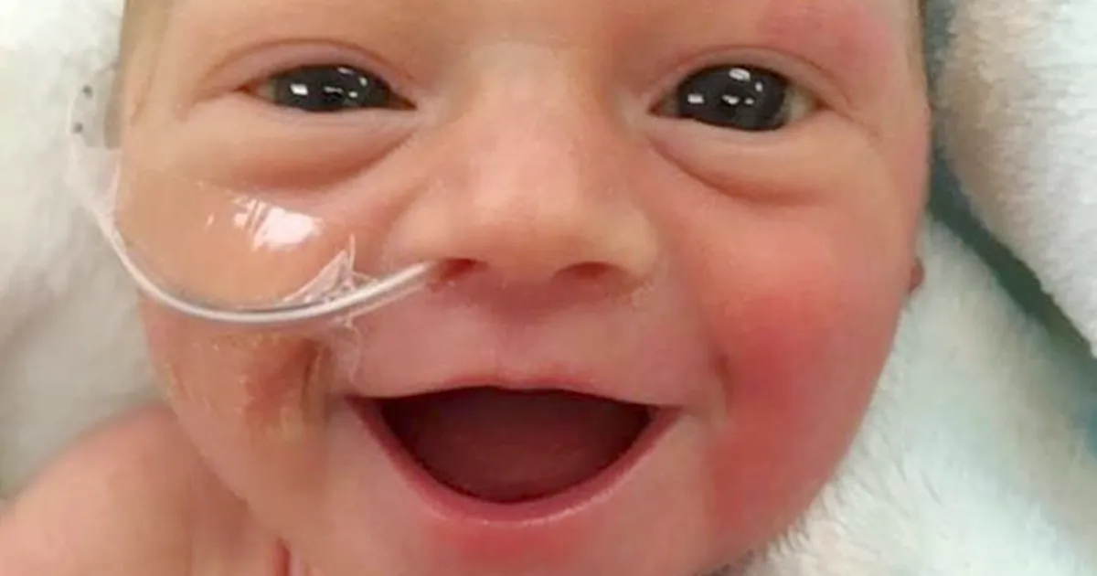 Este bebé prematuro sonríe de oreja a oreja 5 días después de nacer