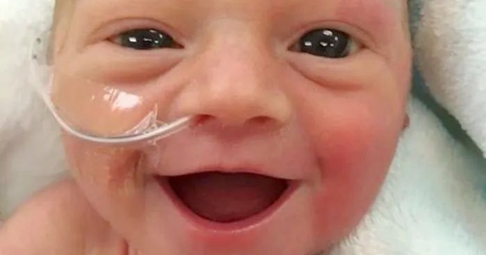 Premature Baby Smiles From Ear To Ear 5 Days After Being Born