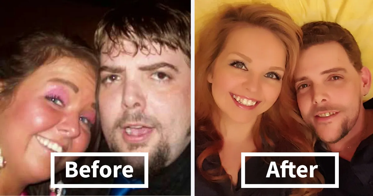 65 Before-And-After Pics Show What Happens When You Stop Drinking (Part 2)