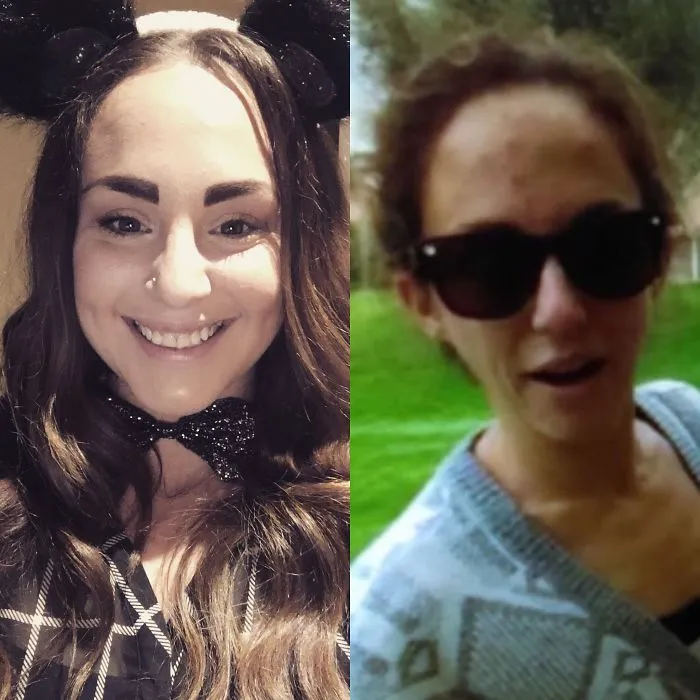 Side-by-side before and after photos showing facial transformation after quitting drinking, highlighting positive health changes.