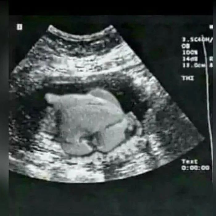 Expecting In Two Weeks