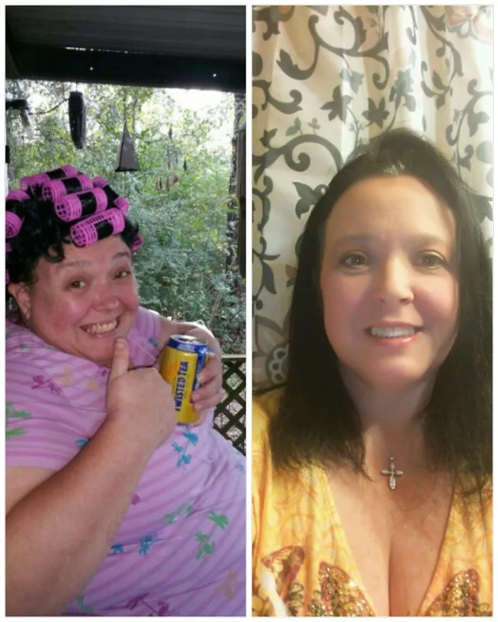 Before-and-after transformation of a woman showing changes after stopping drinking.