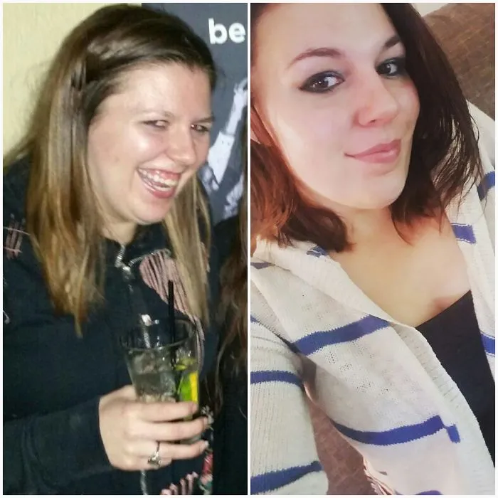 Before and after photos showing changes after stopping drinking alcohol.