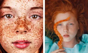 98 Freckled People Who'll Hypnotize You With Their Unique Beauty