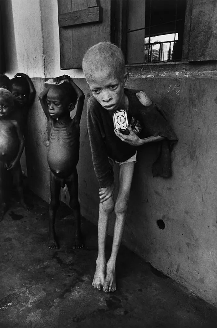 Albino Boy, Biafra, Don Mccullin, 1969