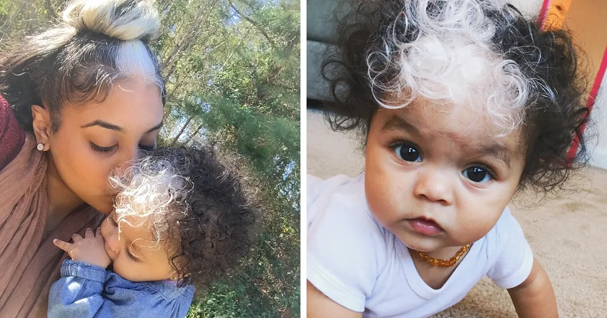 Esta niña ha nacido con un mechón de pelo blanco, igual que su madre