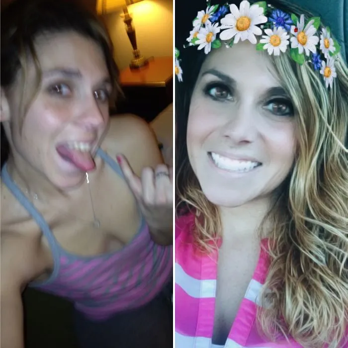 Side-by-side before and after photos showing changes in a woman’s appearance after stopping drinking alcohol.