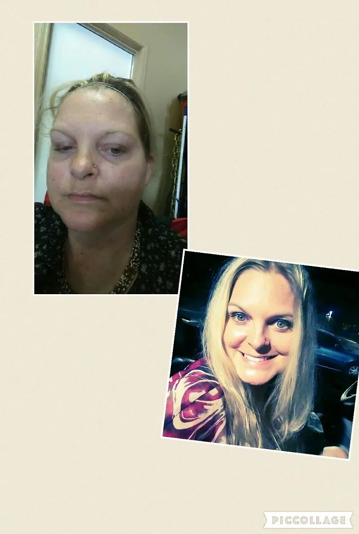 Before-and-after photos showing a woman’s improved complexion and happiness after she stopped drinking alcohol.