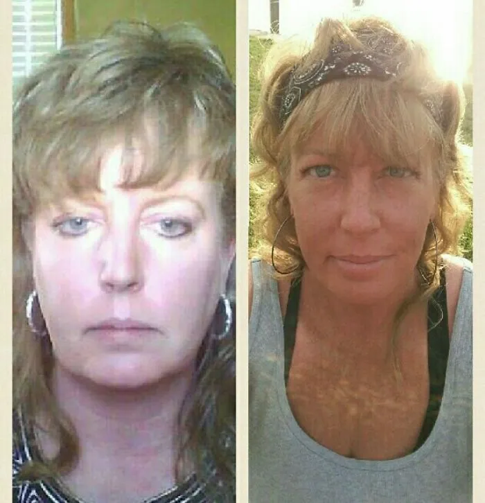 Before and after image showing a woman's transformation after quitting alcohol.